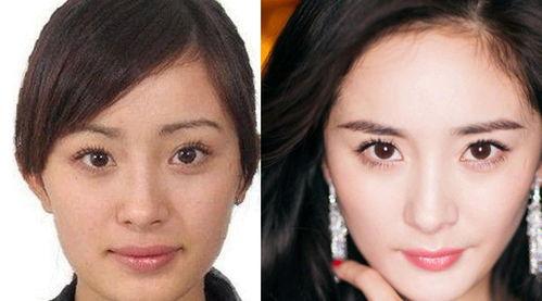 女明星开眼角,揭秘美丽背后的秘密